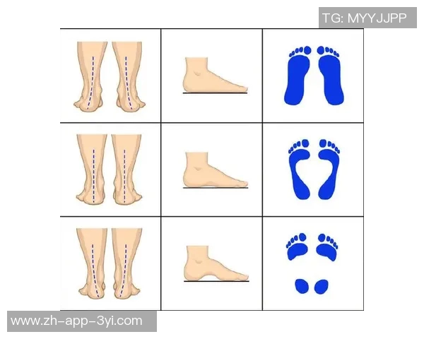 锡安因左脚骨挫伤缺席训练透露落地时踩到对手脚上并无大碍